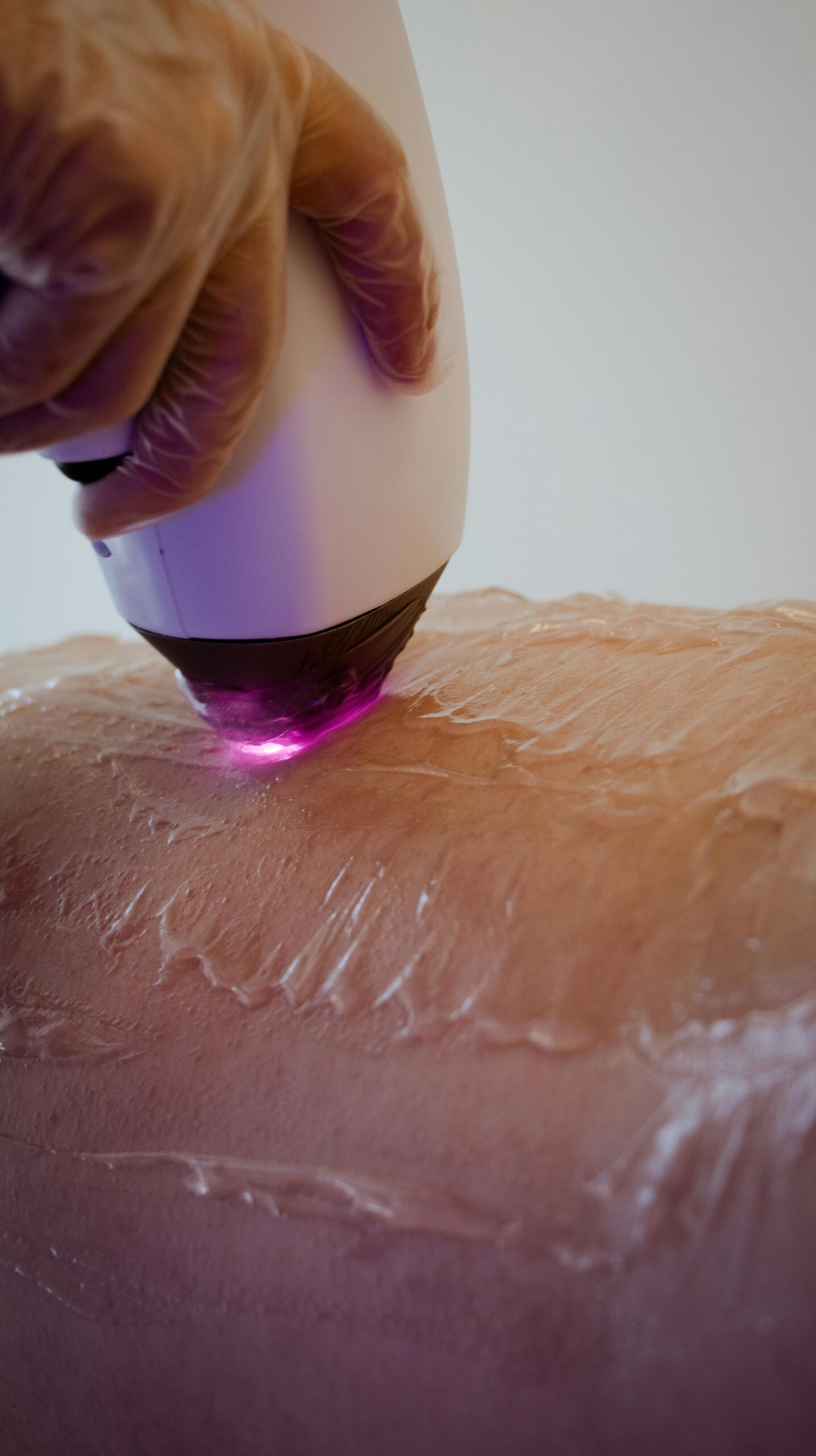 TLR-stock-lasertattooremoval1